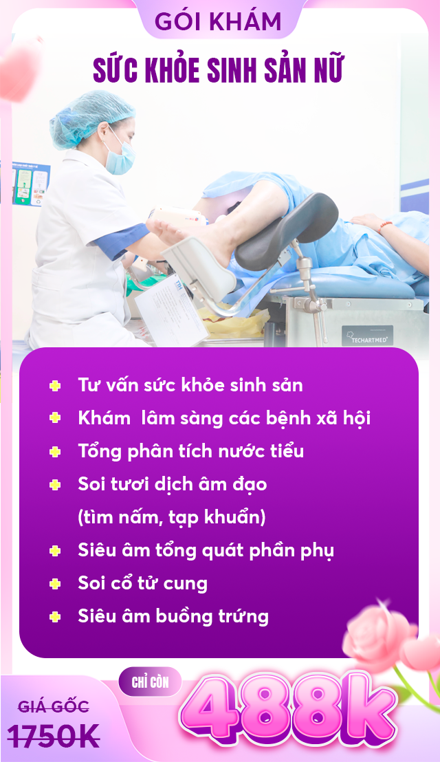 Gói ưu đãi