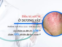 Nam giới bị nứt nẻ ở dương vật cần điều trị kịp thời