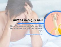 Nứt da bao quy đầu có sao không?