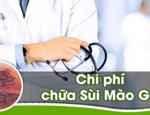 Chi phí chữa sùi mào gà bao nhiêu tiền