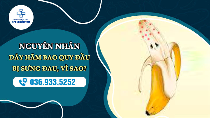 Viêm dây hãm bao quy đầu là gì?
