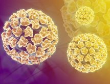 Những điều nên biết trước khi xét nghiệm hpv