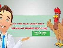 Sùi mào gà mọc ở đâu? Những vị trí mọc sùi mào gà cần lưu ý