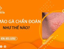 Bác sĩ chẩn đoán sùi mào gà như thế nào?