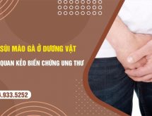 Bệnh sùi mào gà ở dương vật: Chớ chủ quan kẻo biến chứng ung thư