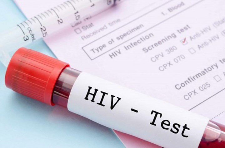KIỂM TRA HIV CHÍNH XÁC NHẤT BẰNG PHƯƠNG PHÁP NÀO?