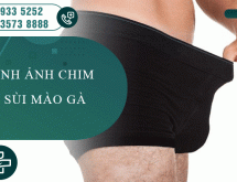 Hình ảnh bị sùi mào gà ở vùng kín và Hình ảnh trước sau khi điều trị