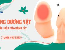 [Bác sĩ giải đáp] Sưng dương vật là dấu hiệu của bệnh gì? Có nguy hiểm không?