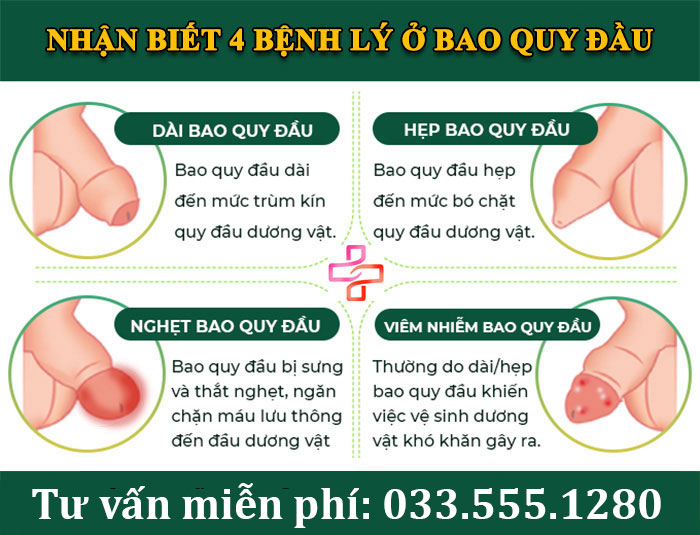 Bao quy đầu là gì? 3 Chức năng và 4 Bệnh lý thường gặp ở bao quy đầu