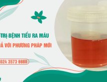 Điều trị bệnh tiểu ra máu bằng phương pháp mới được hơn 90% người bệnh lựa chọn