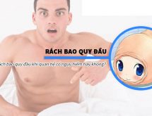 Thật không thể ngờ, rách đầu dương vật khi quan hệ có thể lấy sùi mào gà đến 90%