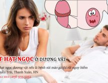 Đốt hạt ngọc dương vật và những điều đàn ông cần phải biết