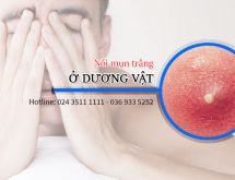 Nổi mụn trắng ở dương vật dấu hiệu 90% mắc các bệnh xã hội