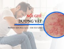 Dấu hiệu dương vật bị ghẻ là bệnh gì phái mạnh?