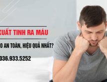 Hướng đi mới trong chữa xuất tinh ra máu mang lại hiệu quả vượt trội