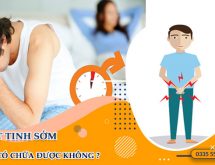 [CHUYÊN GIA GIẢI ĐÁP] XUẤT TINH SỚM CÓ CHỮA ĐƯỢC KHÔNG?