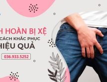 Tinh hoàn bị xệ và dài thõng xuống là bệnh gì? Hướng điều trị hiệu quả