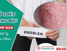 Bị lở loét ở bìu – Dấu hiệu cảnh báo nhiều bệnh lý nguy hiểm