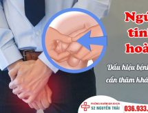 [Chuyên gia giải đáp] Ngứa tinh hoàn do đâu và cách khắc phục hiệu quả nhất