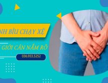 Bệnh xệ bìu: Nguyên nhân và cách điều trị hiệu quả nhất