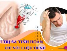 Chia sẻ của bác sĩ về cách điều trị bệnh sa bìu tinh hoàn