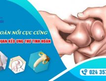 Tinh hoàn nổi cục cứng – Chớ chủ quan kẻo ung thư tinh hoàn