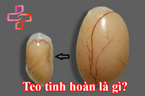 teo-tinh-hoan-la-gi