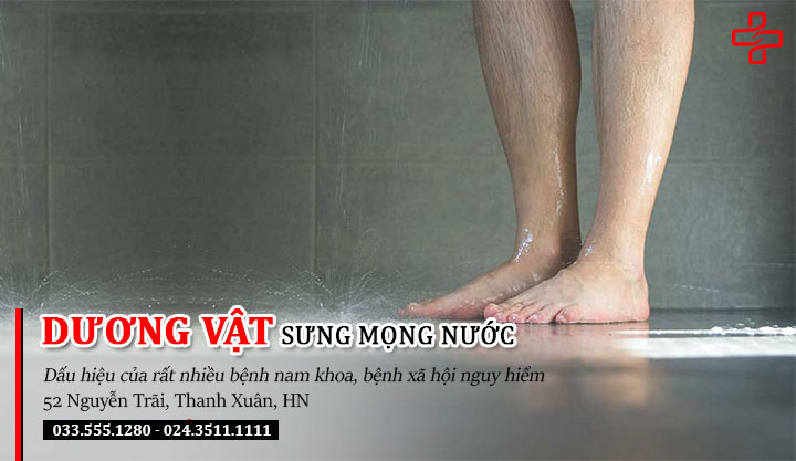 điều trị dương vật sưng mọng nước 