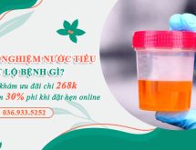 Kết quả xét nghiệm nước tiểu tiết lộ điều gì?