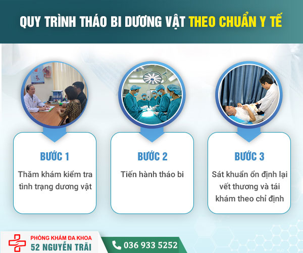 quy trình tháo bi an toàn tại phòng khám Đa khoa 52 Nguyễn Trãi