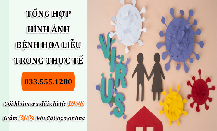 Bệnh hoa liễu là bệnh gì? Nhận biết nhanh qua hình ảnh thực tế bệnh hoa liễu