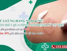 Tất tần tật các bệnh lý gây ngứa vùng háng ở nam & nữ