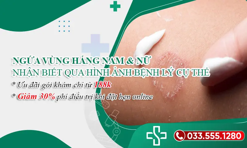 Các bệnh lý gây ngứa vùng háng ở nam và nữ