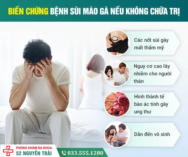 Biến chứng nguy hiểm của mụn cóc sinh dục