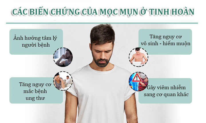 Biến chứng mọc mụn ở tinh hoàn nếu không được chữa kịp thời