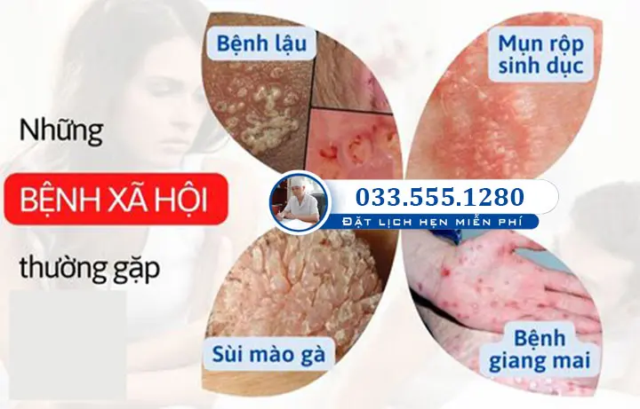 Các bệnh xã hội thường gặp