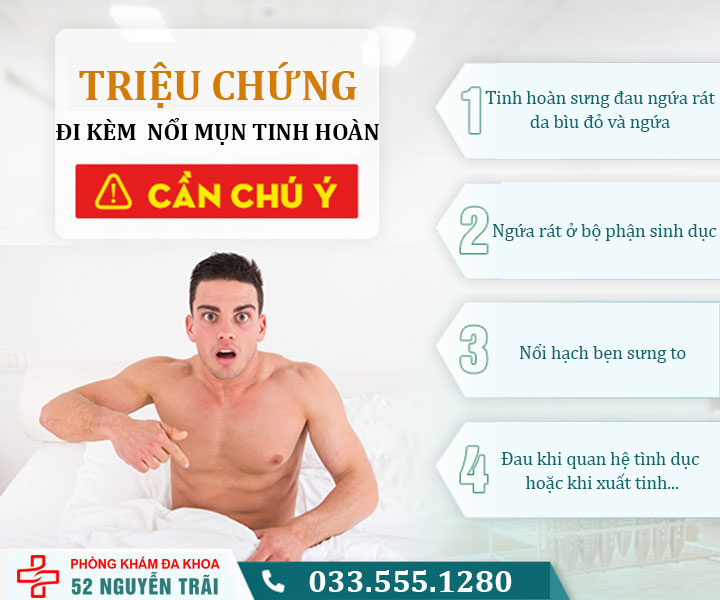 Dấu hiệu đi kèm mụn ở tinh hoàn cần khám ngay