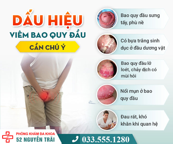 Dấu hiệu viêm bao quy đầu