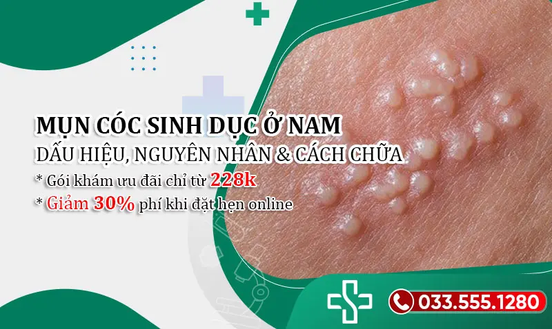 Mụn cóc sinh dục ở nam giới