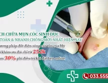 Tham khảo phương pháp chữa mụn cóc sinh dục mới nhất hiện nay