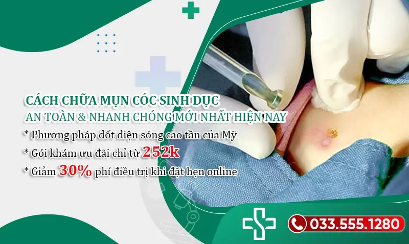 Phương pháp chữa mụn cóc sinh dục hiện đại mới