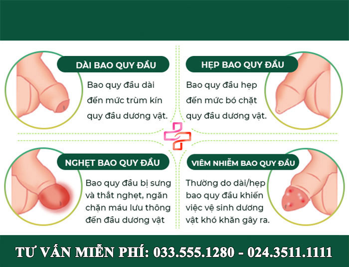 Tổng quát A-Z về bao quy đầu: 4 Chức năng, 6 Bệnh lý, 5 Nguyên nhân và Các phương pháp điều trị chuẩn Y khoa