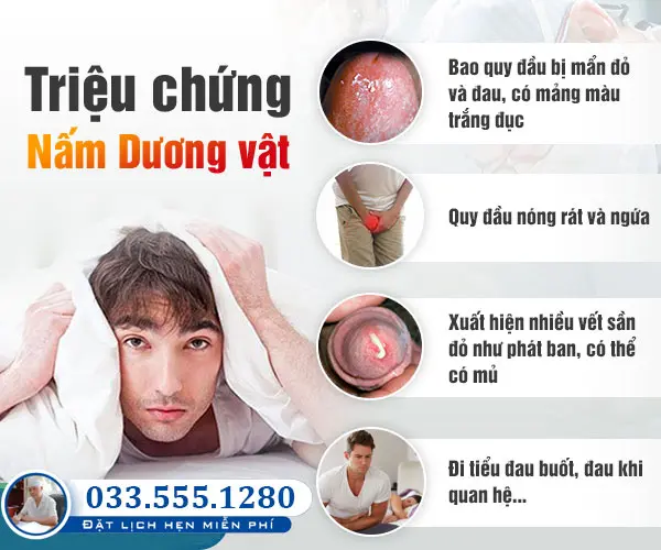 Dấu hiệu nấm ở dương vật