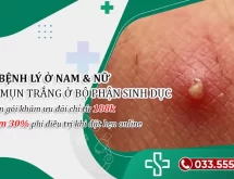 Mụn trắng ở bộ phận sinh dục nam & nữ cảnh báo bị bệnh gì?