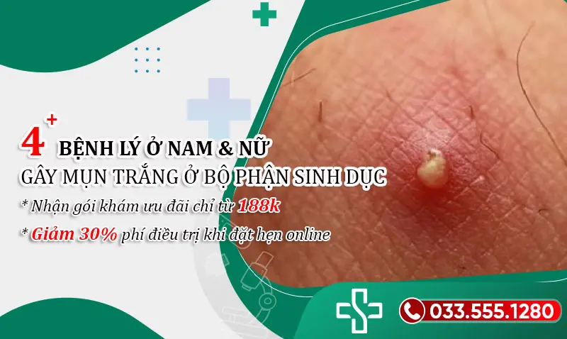 Mụn trắng ở bộ phận sinh dục nam & nữ cảnh báo bị bệnh gì? 