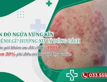 Nổi mẩn ngứa vùng kín là bệnh gì? Mách bạn hướng xử lý đúng cách