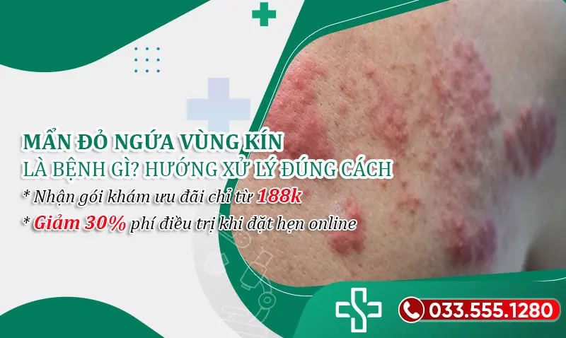 Nổi mẩn ngứa vùng kín là bệnh gì?