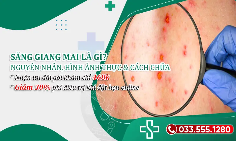 Săng giang mai là gì? Nguyên nhân, Hình ảnh thực tế và cách chữa trị