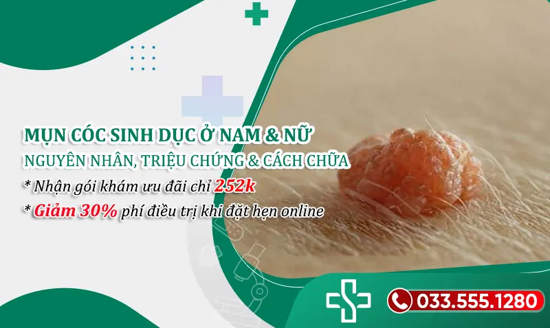 Các triệu chứng mụn cóc sinh dục và cách chữa