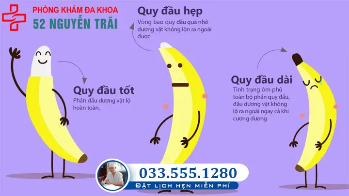 Hình ảnh hẹp,dài bao quy đầu